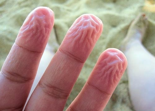 9 Cách tự vệ kì lạ của cơ thể mà không phải ai cũng nhận ra